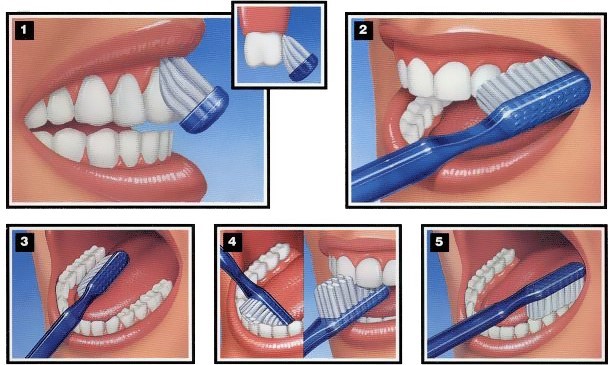 Técnica de cepillado dental