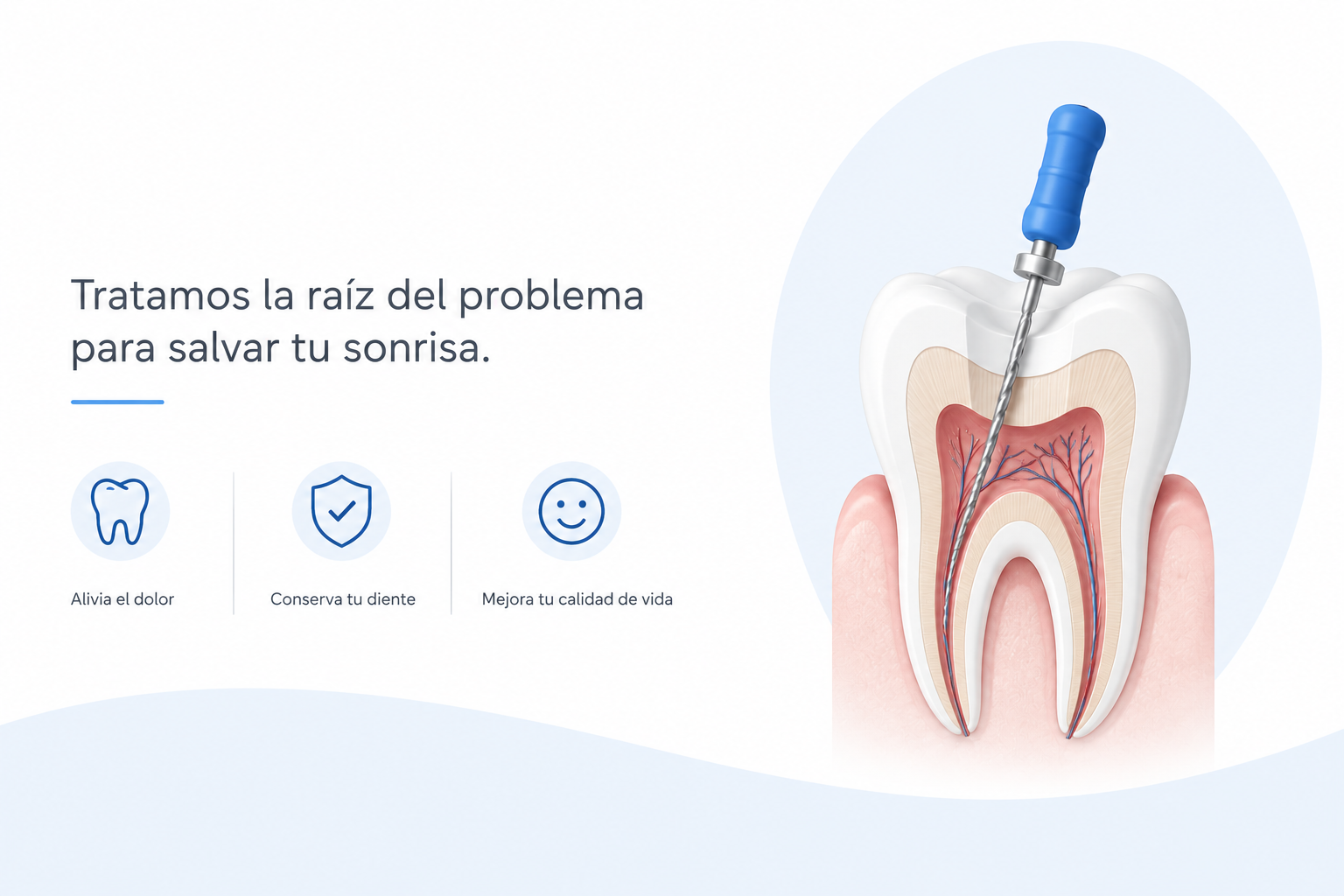 Endodoncia Extracción